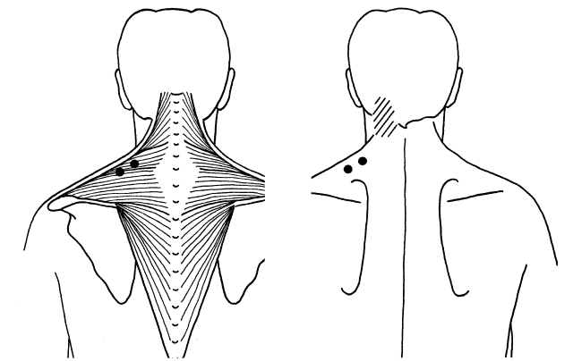 Diagram of neck muscles. 